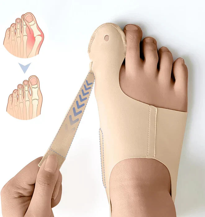 Bunion Corrector