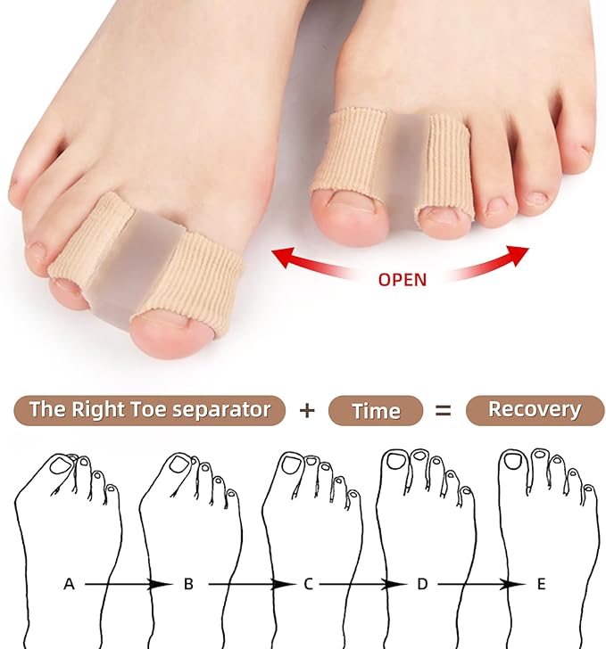 AlignStep™ Bunion Toe Separator