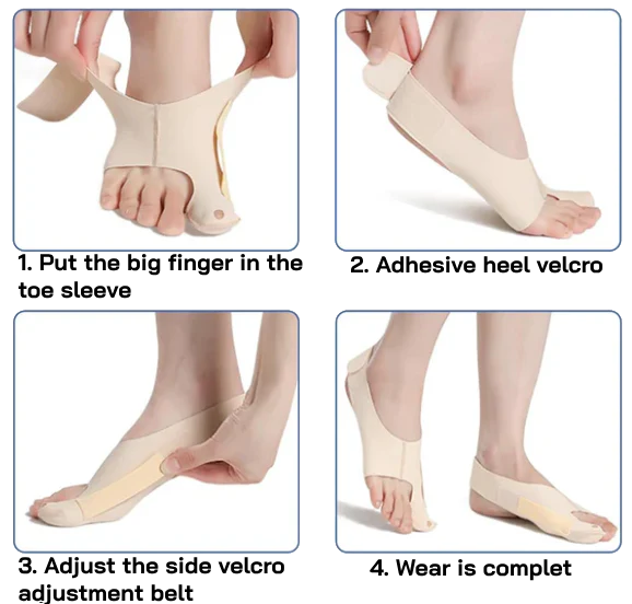 BunionEase™ : The Perfect Bunion Corrector