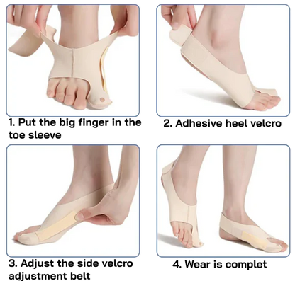 BunionEase™ : The Perfect Bunion Corrector