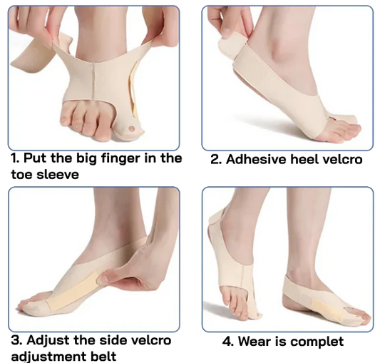 BunionEase™ : The Perfect Bunion Corrector