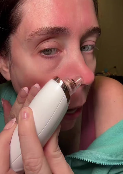 ZenRelief PorePure™ Blackhead Vacuum Reveal Cleaner, Fresher-Looking Skin From the Comfort of Home
