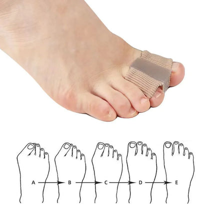 AlignStep™ Bunion Toe Separator